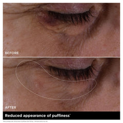 Double Serum Eye - New