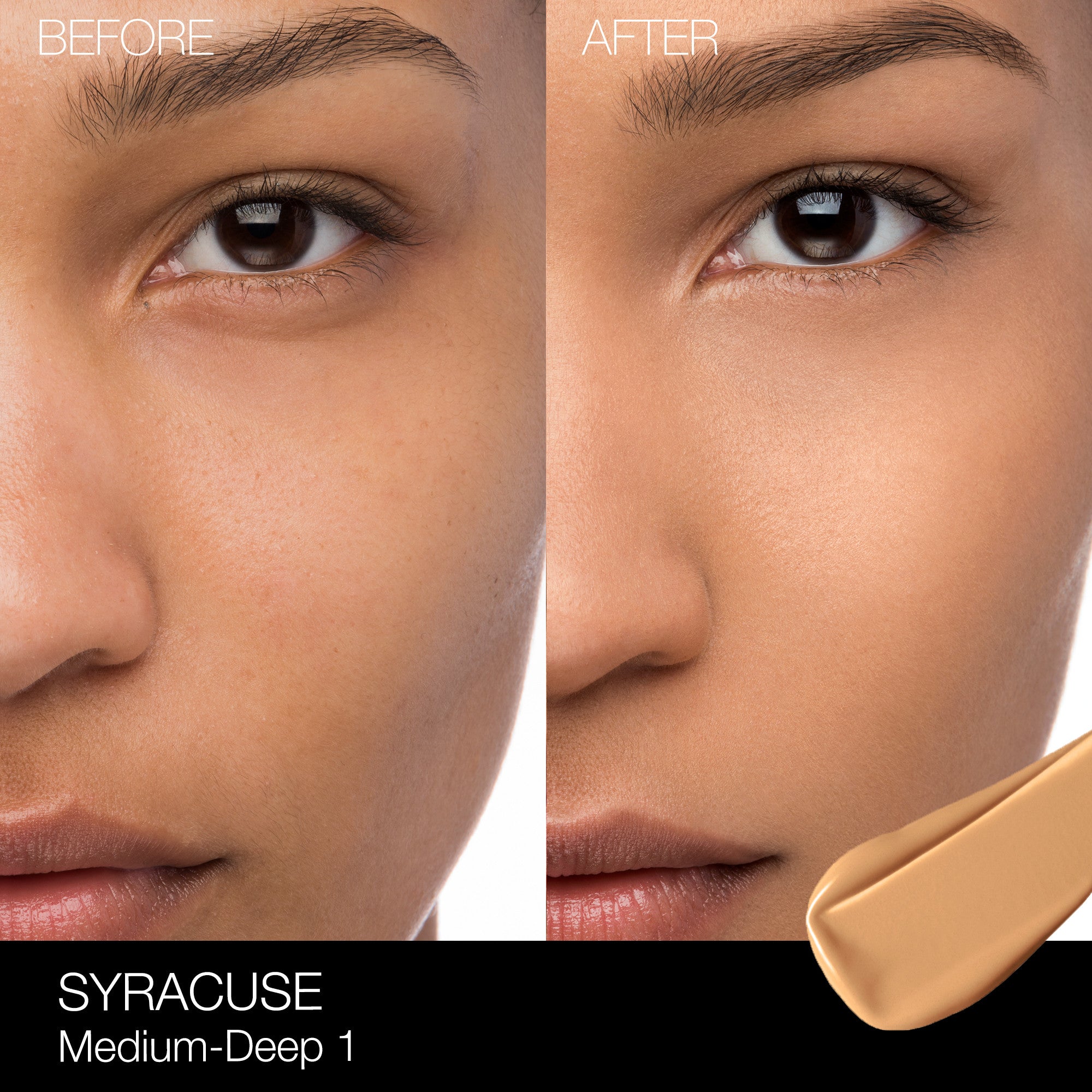 SYRACUSE