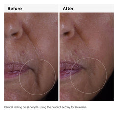 GF Solution 15% Serum