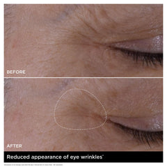 Double Serum Eye - New