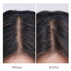 Oily Scalp Treatment