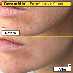 Ceramidin™ Ectoin-Infused Cream