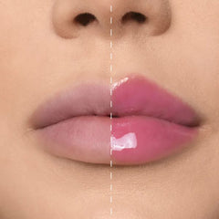 Lip Phenom™