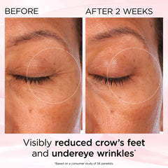 Elizabeth Arden Retinol + HPR Ceramide Rapid Skin Renewing Eye Cream